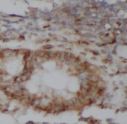 Immunohistochemistry KRT81 Antibody - BSA Free