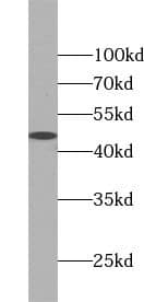 Western Blot: KRT40 Antibody - BSA Free [NBP3-46352] - A431 cells were subjected to SDS PAGE followed by western blot with (KRT40 Antibody) at dilution of 1:500