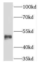 Western Blot Keratin 36 Antibody - BSA Free
