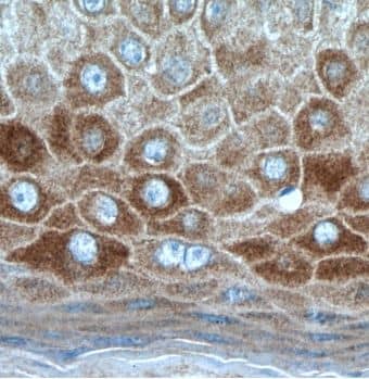 Immunohistochemistry KRT34 Antibody - BSA Free