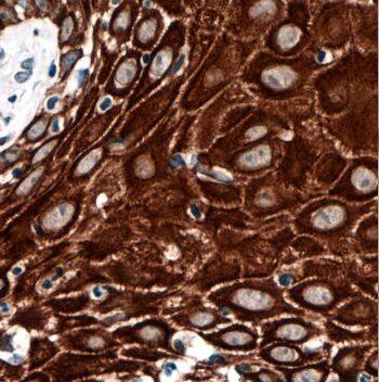 Immunohistochemistry KRTHA3B Antibody - BSA Free