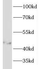 Western Blot: KRTHA3B Antibody - BSA Free [NBP3-46355] - MCF7 cells were subjected to SDS PAGE followed by western blot with (KRTHA3B antibody) at dilution of 1:800