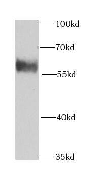 Western Blot KPNA6 Antibody - BSA Free
