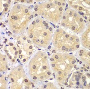 Immunohistochemistry KPNA6 Antibody - BSA Free