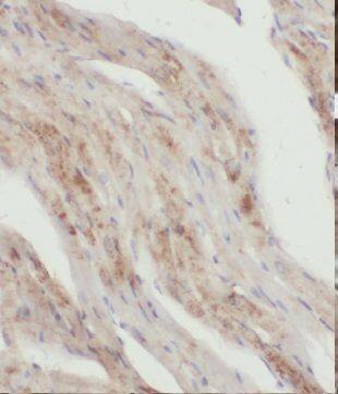 Immunohistochemistry: KLHL35 Antibody - BSA Free [NBP3-46360] - Immunohistochemistry of paraffin-embedded human heart using (KLHL35 antibody) at dilution of 1:100