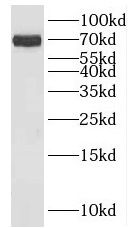 Western Blot: KLHL34 Antibody - BSA Free [NBP3-46361] - Rat testis tissue were subjected to SDS PAGE followed by western blot with ( KLHL34 Antibody) at dilution of 1:600