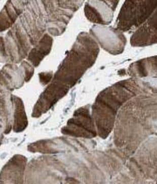 Immunohistochemistry KLHL31 Antibody - BSA Free