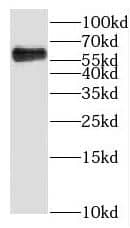 Western Blot KLHL31 Antibody - BSA Free
