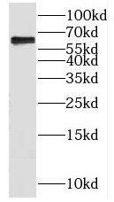 Western Blot KLHL28 Antibody - BSA Free