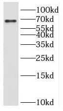 Western Blot Kelch-Like Family Member 21 Antibody - BSA Free