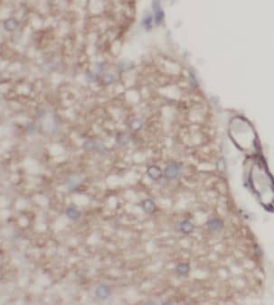 Immunohistochemistry Kelch-Like Family Member 21 Antibody - BSA Free