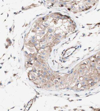 Immunohistochemistry KLHL12/C3IP1 Antibody - BSA Free