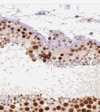 Immunohistochemistry KLHDC3 Antibody - BSA Free