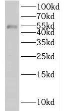 Western Blot KLHDC3 Antibody - BSA Free