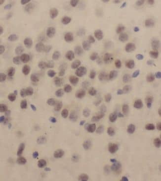 Immunohistochemistry: KLF13 Antibody - BSA Free [NBP3-46377] - Immunohistochemistry of paraffin-embedded human brain using (KLF13 antibody) at dilution of 1:50