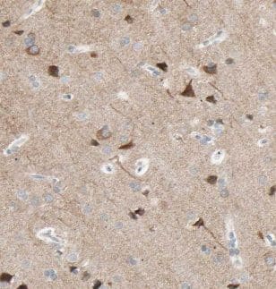 Immunohistochemistry KLC2 Antibody - BSA Free