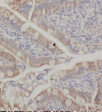 Immunohistochemistry KCNJ13 Antibody - BSA Free