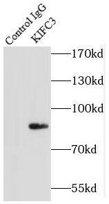 Immunoprecipitation: KIFC3 Antibody - BSA Free [NBP3-46387] - IP Result of anti-KIFC3 (IP:, 4ug; Detection: 1:500) with mouse kidney tissue lysate 7200ug.