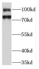 Western Blot: KIFC3 Antibody - BSA Free [NBP3-46387] - Mouse lung tissue were subjected to SDS PAGE followed by western blot with (KIFC3 antibody) at dilution of 1:500