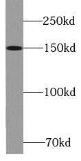 Western Blot: KIF7 Antibody - BSA Free [NBP3-46388] - HEK-293 cells were subjected to SDS PAGE followed by western blot with ( KIF7 Antibody) at dilution of 1:1000