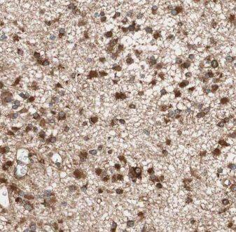 Immunohistochemistry Kif3c Antibody - BSA Free