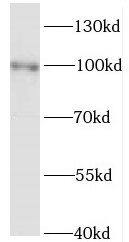 Western Blot: Kif3c Antibody - BSA Free [NBP3-46391] - Y79 cells were subjected to SDS PAGE followed by western blot with (Kif3c antibody) at dilution of 1:800
