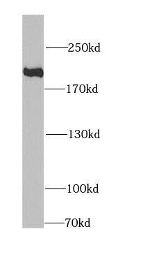 Western Blot KIF1B Antibody - BSA Free