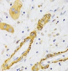 Immunohistochemistry KIF1B Antibody - BSA Free