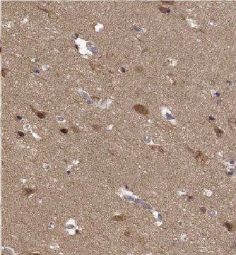 Immunohistochemistry KIF19 Antibody - BSA Free