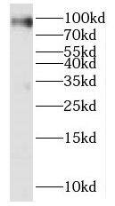 Western Blot: KIF19 Antibody - BSA Free [NBP3-46395] - Human brain tissue were subjected to SDS PAGE followed by western blot with (KIF19 antibody) at dilution of 1:300