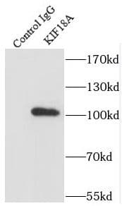 Immunoprecipitation: KIF18A Antibody - BSA Free [NBP3-46396] - IP Result of anti-KIF18A (IP:, 4ug; Detection: 1:500) with Jurkat cells lysate 2400ug.