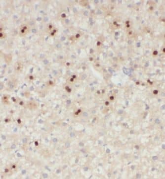 Immunohistochemistry: KIF18A Antibody - BSA Free [NBP3-46396] - Immunohistochemistry of paraffin-embedded human liver using (KIF18A antibody) at dilution of 1:100