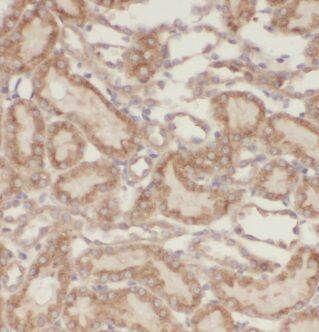 Immunohistochemistry: KIF12 Antibody - BSA Free [NBP3-46397] - Immunohistochemistry of paraffin-embedded human kidney tissue slide using (KIF12 Antibody) at dilution of 1:50