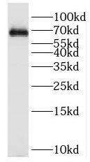 Western Blot: KIF12 Antibody - BSA Free [NBP3-46397] - Y79 cells were subjected to SDS PAGE followed by western blot with (KIF12 antibody) at dilution of 1:400