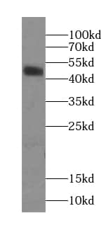 Western Blot: CCDC183 Antibody - BSA Free [NBP3-46399] - HeLa cells were subjected to SDS PAGE followed by western blot with ( CCDC183 Antibody) at dilution of 1:600