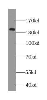 Western Blot: NCKAP5L Antibody - BSA Free [NBP3-46400] - HeLa cells were subjected to SDS PAGE followed by western blot with (NCKAP5L antibody) at dilution of 1:300