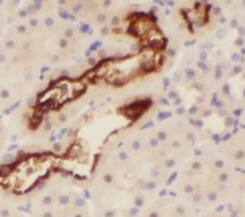Immunohistochemistry: NCKAP5L Antibody - BSA Free [NBP3-46400] - Immunohistochemistry of paraffin-embedded human skin using (NCKAP5L antibody) at dilution of 1:50