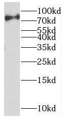 Western Blot: UVSSA Antibody - BSA Free [NBP3-46401] - Raji cells were subjected to SDS PAGE followed by western blot with ( UVSSA Antibody) at dilution of 1:300