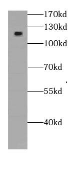 Western Blot: SKT Antibody - BSA Free [NBP3-46403] - Mouse colon tissue were subjected to SDS PAGE followed by western blot with ( SKT Antibody) at dilution of 1:600