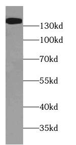 Western Blot: WASHC4 Antibody - BSA Free [NBP3-46405] - HeLa cells were subjected to SDS PAGE followed by western blot with ( WASHC4 Antibody) at dilution of 1:300