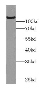 Western Blot: C2CD5 Antibody - BSA Free [NBP3-46408] - HeLa cells were subjected to SDS PAGE followed by western blot with (C2CD5 antibody) at dilution of 1:1000