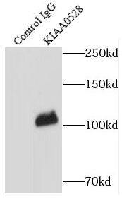 Immunoprecipitation: C2CD5 Antibody - BSA Free [NBP3-46408] - IP Result of anti-C2CD5 (IP:, 4ug; Detection: 1:700) with HeLa cells lysate 520ug.