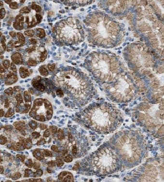 Immunohistochemistry: EFCAB14 Antibody - BSA Free [NBP3-46410] - Immunohistochemistry of paraffin-embedded human stomach tissue slide using (EFCAB14 Antibody) at dilution of 1:50