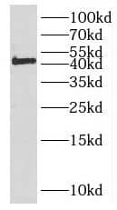 Western Blot: EFCAB14 Antibody - BSA Free [NBP3-46410] - COLO 320 cells were subjected to SDS PAGE followed by western blot with (EFCAB14 Antibody) at dilution of 1:600