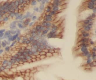 Immunohistochemistry LKAP Antibody - BSA Free