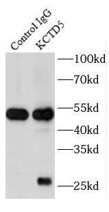 Immunoprecipitation: KCTD5 Antibody - BSA Free [NBP3-46419] - IP Result of anti-KCTD5 (IP:, 4ug; Detection: 1:500) with HeLa cells lysate 1200ug.