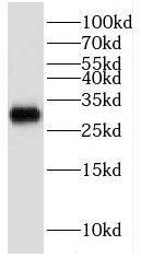 Western Blot: KCNIP4 Antibody - BSA Free [NBP3-46429] - Rat brain tissue were subjected to SDS PAGE followed by western blot with ( KCNIP4 Antibody) at dilution of 1:2000