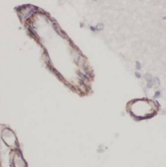 Immunohistochemistry: KvBeta1 Antibody - BSA Free [NBP3-46435] - Immunohistochemistry of paraffin-embedded human brain using (KvBeta1 antibody) at dilution of 1:100