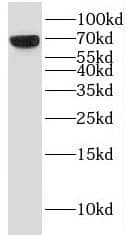Western Blot: KBTBD10 Antibody - BSA Free [NBP3-46438] - Mouse heart tissue were subjected to SDS PAGE followed by western blot with (KBTBD10 Antibody) at dilution of 1:1500