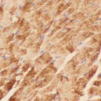 Immunohistochemistry: KBTBD10 Antibody - BSA Free [NBP3-46438] - Immunohistochemistry of paraffin-embedded human skeletal muscle tissue slide using (KBTBD10 Antibody) at dilution of 1:50